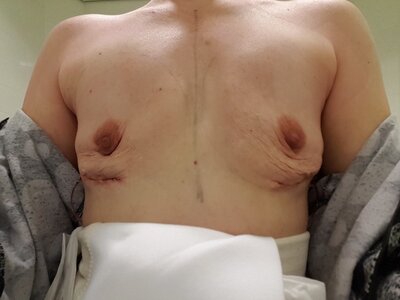 4.5 uur na de operatie