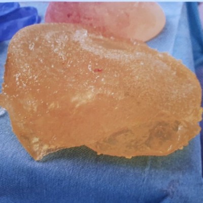 Protheses 2 en 1 verkleind.jpg