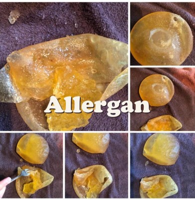 Allergan.jpg